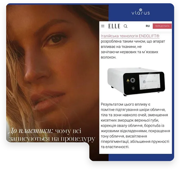 Отзыв международной прессы о лазерной системе Lasemar 1500 Endolift