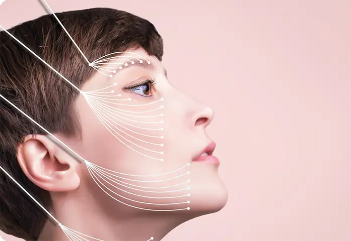 Зоны подтяжки кожи по процедуре Endolift